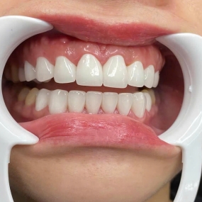 Chị Thanh - Quận Bình Tân