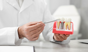 Trồng Răng Implant Có Đau Không? Giải Đáp Từ Chuyên Gia Nha Khoa