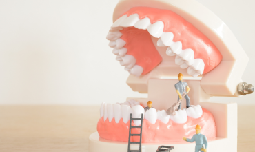 Những Thực Phẩm Tốt Cho Răng Miệng - Bí Quyết Giữ Răng Chắc Khỏe