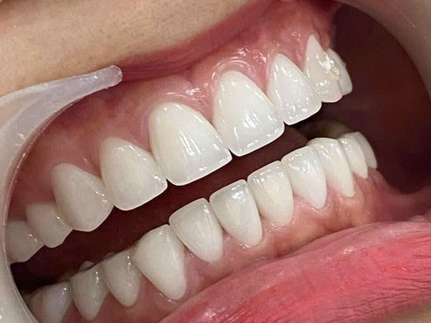 Chị Diễm - Quận 07