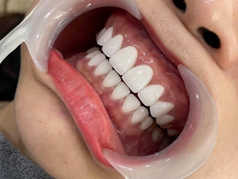 Chị Thanh - Quận Bình Tân