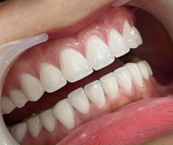 Chị Diễm - Quận 07