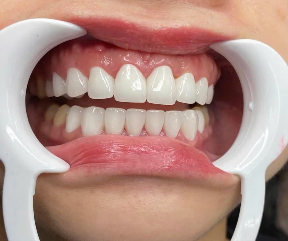 Chị Thanh - Quận Bình Tân